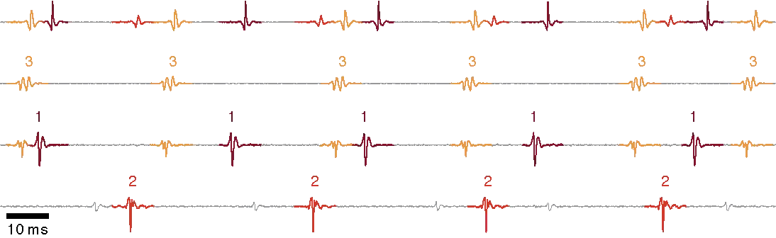 traces of motor unit activity