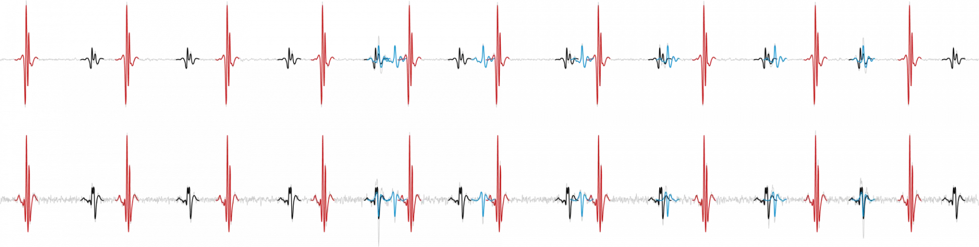 Three motor units